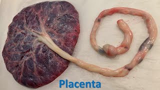 Placenta Prof Dr Md Ashfaqur Rahman [upl. by Ilehs]