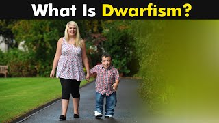 What is Dwarfism  Types Causes and Symptoms UrduHindi [upl. by Biernat321]