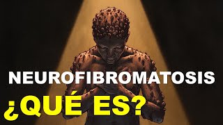 Neurofibromatosis  ¿Qué es [upl. by Sirromaj]