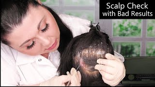 ASMR Scalp Check with Bad Results Dandruff Removal Scalp Treatment Whispering Medical Roleplay [upl. by Allayne292]