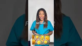 Trying to lose weight You may have leptin resistance Dr Kikie Gardner [upl. by Melodie]