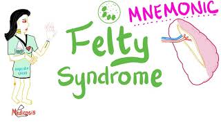 Felty Syndrome Mnemonic  Rheumatoid Arthritis Rheumatology Series [upl. by Llehcram56]