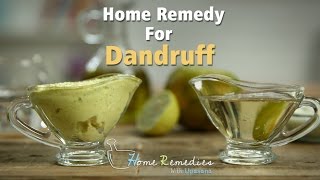 Dandruff Treatment At Home  Dandruff Home Remedies  Home Remedies With Upasana [upl. by Quennie]