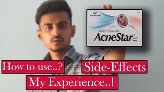 Acnestar Soap  Acne transformation with Acnestar soap Benzoyl peroxide 25 [upl. by Brew]