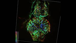 3D rendering of endothelial cells in the brain of an adult transgenic D cerebrum [upl. by Eitak]