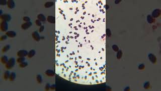 Candida species in urine culture microscope microbiology bmltlecture study music [upl. by Adaurd248]