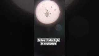 mites under light microscope at 10x microscope microscopic [upl. by Patric296]