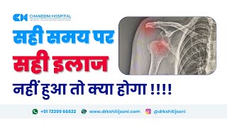 Shoulder dislocation ko nazarandaaj karne ka nuksaan  Patient testimonial [upl. by Norma]