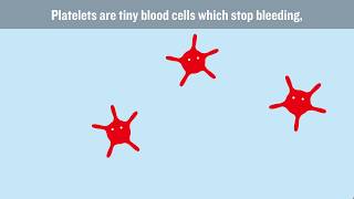 What causes DVT and how can we stop it [upl. by Euqnom]