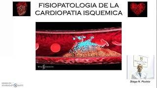 Fisiopatologia De la Cardiopatia Isquemica [upl. by Iand]