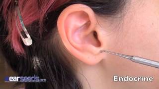 Endocrine Auriculotherapy Ear Point [upl. by Eetsirk]