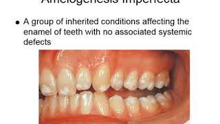 Oral Manifestations of Genetic Abnormalities  Oral Pathology Lecture Ch 6 Pt 2 [upl. by Cadmann243]