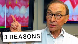 3 Reasons Why Your Gums Are Inflamed 🦷🔥  How to Treat at Home [upl. by Henley]