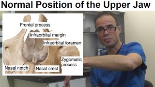 What is the Normal Position Posture of the Upper Jaw Maxilla or Palate by Dr Mike Mew [upl. by Robb]