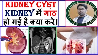 RENAL CORTICAL CYSTKIDNEY CYST TYPES CAUSE KIDNEY CYST TREATMENTPOLYCYSTIC KIDNEY DISEASE [upl. by Dorlisa]