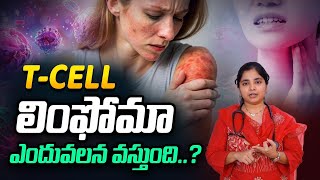 TCell Lymphoma అనేది ఒక అరుదైన క్యాన్సర్  Cancer  Cancer treatment  DrByreddy Poojitha  kaizen [upl. by Ramed]