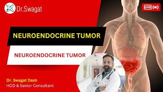 Neuroendocrine Cancer I Neuroendocrine Tumour in Hindi I Dr Swagat Dash [upl. by Hsekin]