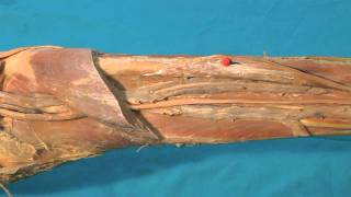 Arcus tendineus musculi solei canalis musculofibularis HD [upl. by Yaron440]