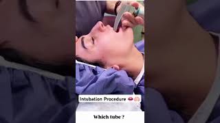 Intubation procedure in 5 seconds 👄🫁 shorts intubation trending youtubeshorts love song [upl. by Dellora]