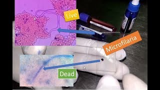 Microfilaria live and dead under Microscope [upl. by Dranek]