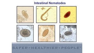 Diagnostic Features of Intestinal Nematodes [upl. by Larrabee]