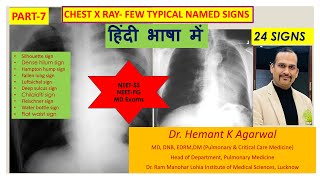 Chest X Ray7 Typical Named Sign हिंदी में Pulmonary Radiology NEETSS Pulmonary Med Hemant [upl. by Rastus]