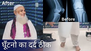 Knee Pain in Treatment For CHIROPRACTIC THERAPY chiropractormoradabad chiropractorindia [upl. by Vic]