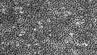 Timelapse movie of MDCK cell monolayer [upl. by Ardnekahs]