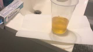 Live pregnancy test Bleach test 9dpo [upl. by Sisto36]