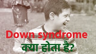 क्या होता है डाउन सिंड्रोम जानिए इस बीमारी के कारण और लक्षण Down Syndrome Causes Types amp Symptoms [upl. by Anivel677]