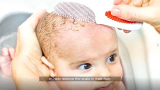 4 cradle cap tips from dermatologists [upl. by Trah]