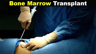 How Does Bone Marrow Transplant Works UrduHindi [upl. by Filbert800]