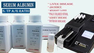 Serum Albumin Test Procedure  Total Protein Albumin Globulin Ratio [upl. by Lipman]