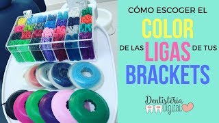 CÓMO ESCOGER EL COLOR DE LAS LIGAS DE TUS BRACKETS  How to choose the color of your braces [upl. by Nohsad321]