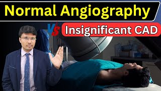 Normal Angiography vs Insignificant CAD vs Recanalized Vessel [upl. by Carly]