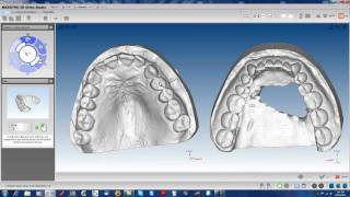 MAESTRO 3D ORTHO STUDIO DEMO VERSION 2 [upl. by Corotto]