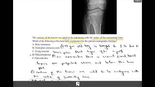 USMLE S2CK Uworld case no 31Osteochondroma [upl. by Sevy]