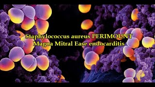 Staphylococcus aureus PERIMOUNT Magna Mitral Ease endocarditis [upl. by Kilgore]