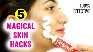 5 Magical Beauty HACKS Using TOOTHPASTE  Pimples Dark Spots Pink Lips  Anaysa [upl. by Nnairret]