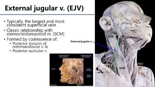 LO4 Veins of Neck [upl. by Ahiel258]