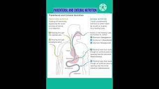 Parenteral nutrition and Enteral nutrition nursingnotes [upl. by Benedetto]