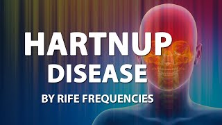 Hartnup Disease  RIFE Frequencies Treatment  Online Sound Therapy  Positive Energy Healing  Pure [upl. by Rosemary]