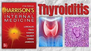 THYROIDITIS  Classification  Causes  Clinical Features  Treatment  Harrision [upl. by Inger]