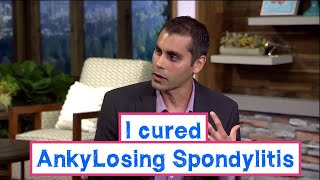 I cured my Ankylosing Spondylitis [upl. by Ynatirb]