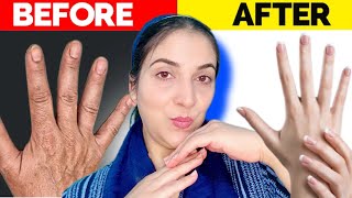 Hand Transformation  Best Remedy For Hand Wrinkles And Sagging Young Beautiful Hands 🙌 [upl. by Ribak206]