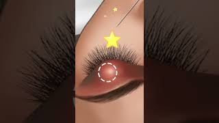 Asmr videos asmr treatment treatment of eyes asmr treatment cartoon [upl. by Annej]