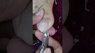 Satisfying Toe Cleaning  Relaxing Foot Care amp Deep Clean ASMR 16 [upl. by Ardelis]