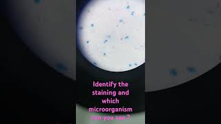 drpreetimicro znstaining mycobacteria microbiology neet medical tuberculosis laboratory [upl. by Rolandson736]