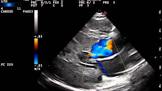 feline hypertrophic cardiomyopathy SAM [upl. by Leirbaj]