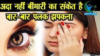 मुश्किल का संकेत हो सकता है बारबार पलक झपकना जानें इसके बारें में Reason for Eye Blink [upl. by Animehliw]